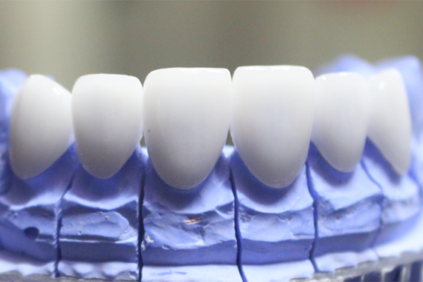 Răng sứ HT Smile